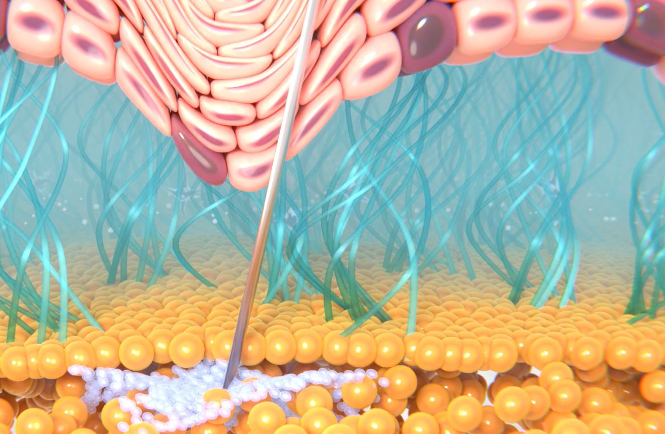 Before Treatment Mode Of Action Video